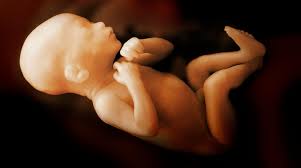 abortion baby